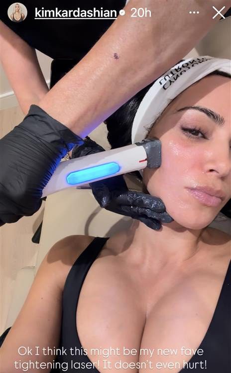kim kardashian getting xerf skin tightening treatment