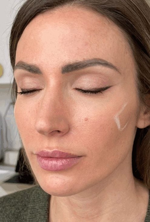 dermal filler cheeks before ahwatukee az
