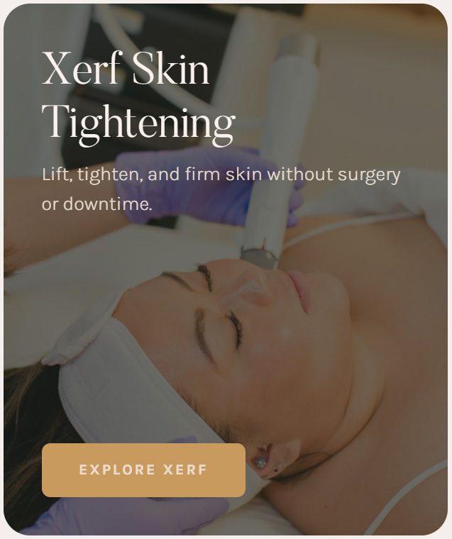 service card xerf