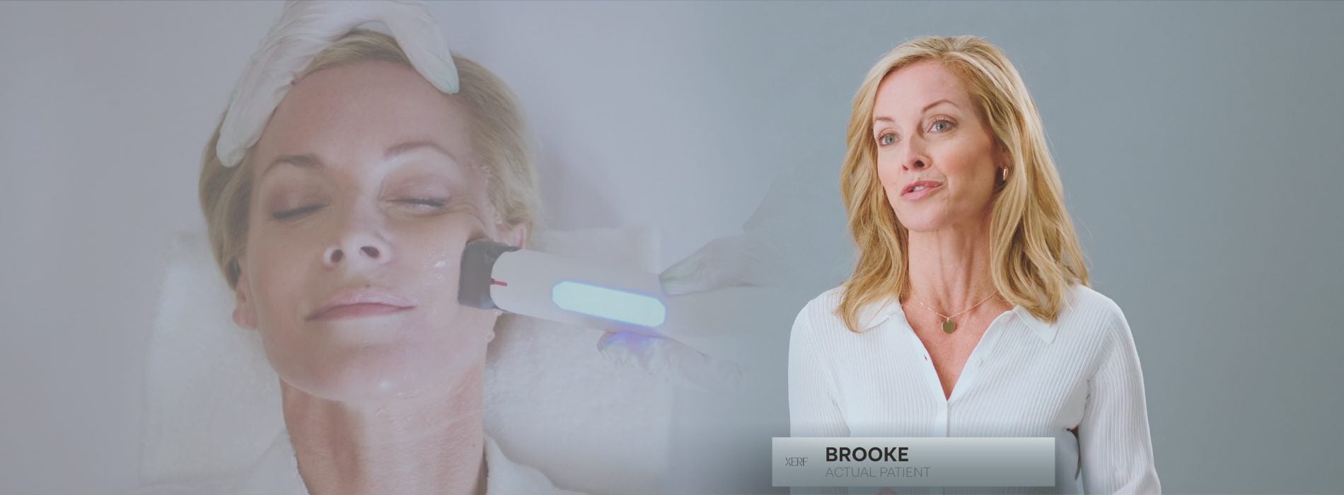 xerf testimonial video cover