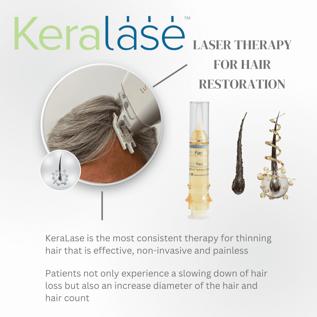 kerafactor keralase laser hair therapy