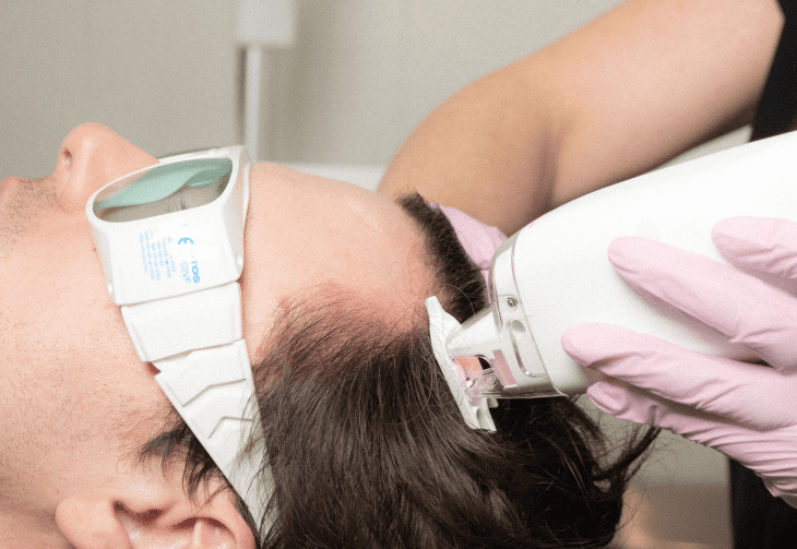 keralase hair loss treatment in phoenix az
