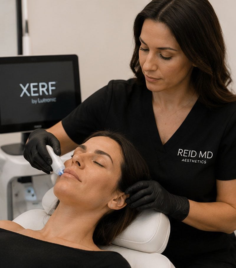 xerf skin tightening south phoenix az ahwatukee az