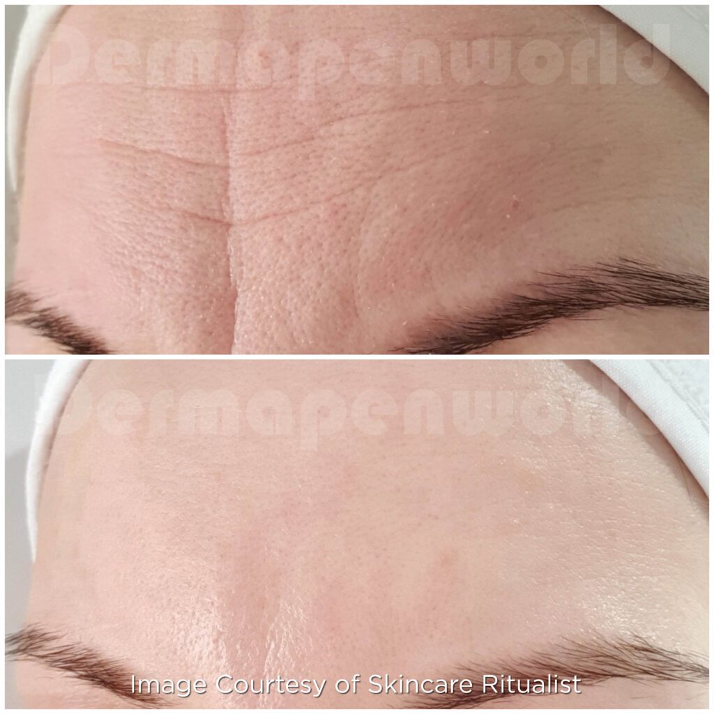 Aging Female A