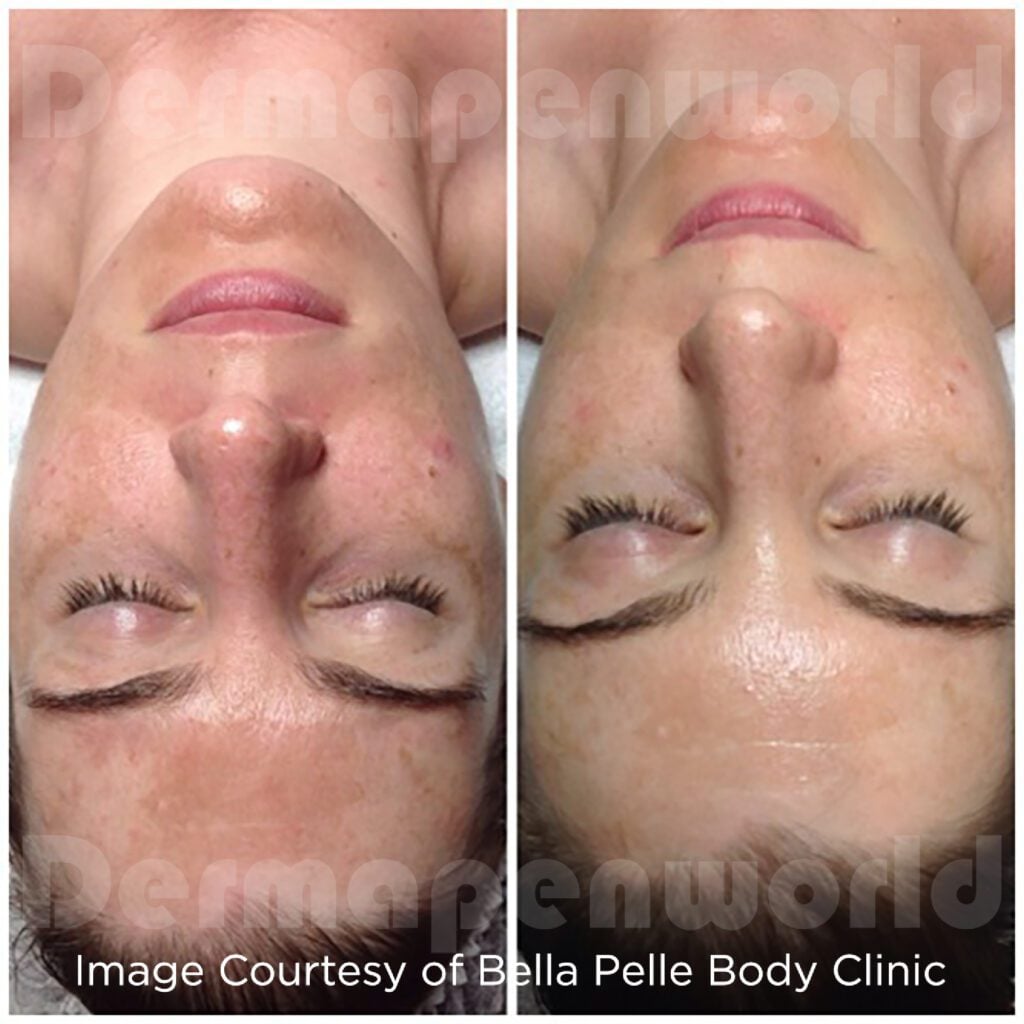 Bella Pelle DP C