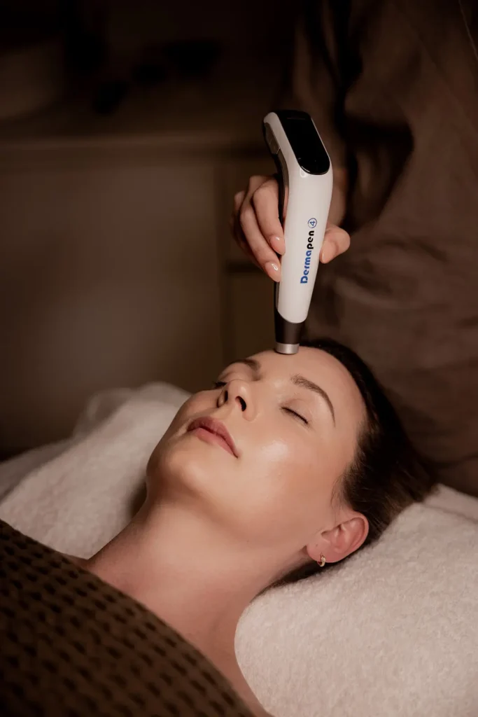 woman getting dermapen microneedling in phoenix az ahwatukee ()