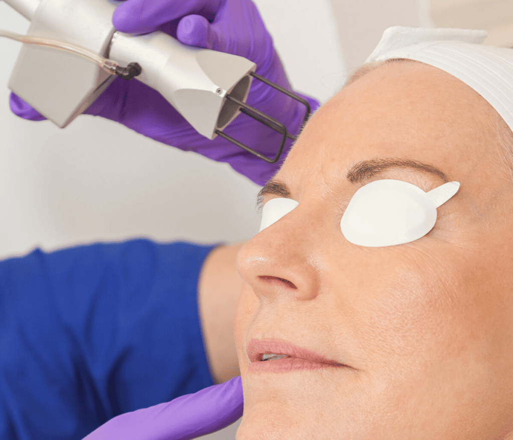 Woman receiving eCO2 3D laser skin resurfacing treatment with protective eye shields