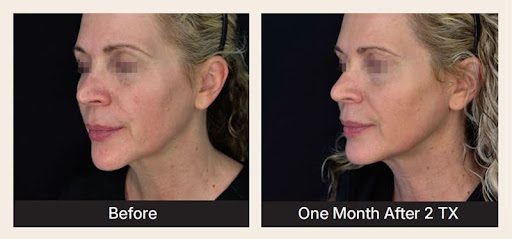 See K LUXE Results