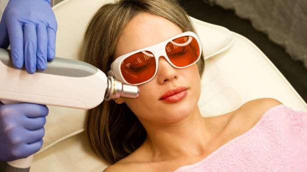 aser Skin Resurfacing