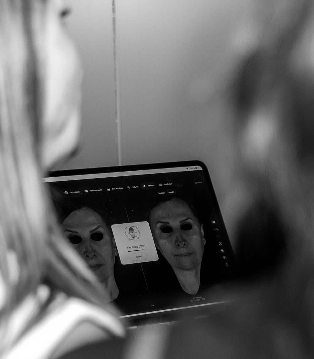 aura d imaging results screen
